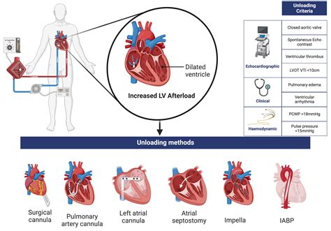 venoarterial ecmo unloading criteria